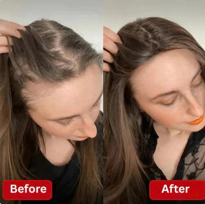 TGIDEAS ROSEMARY SHAMPOO