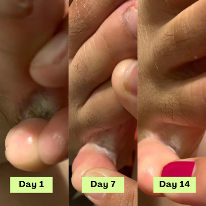 Antifungal Tea Tree Therapy Bar